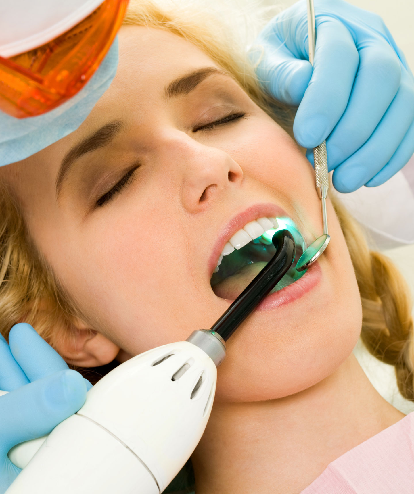 dental veneers houston