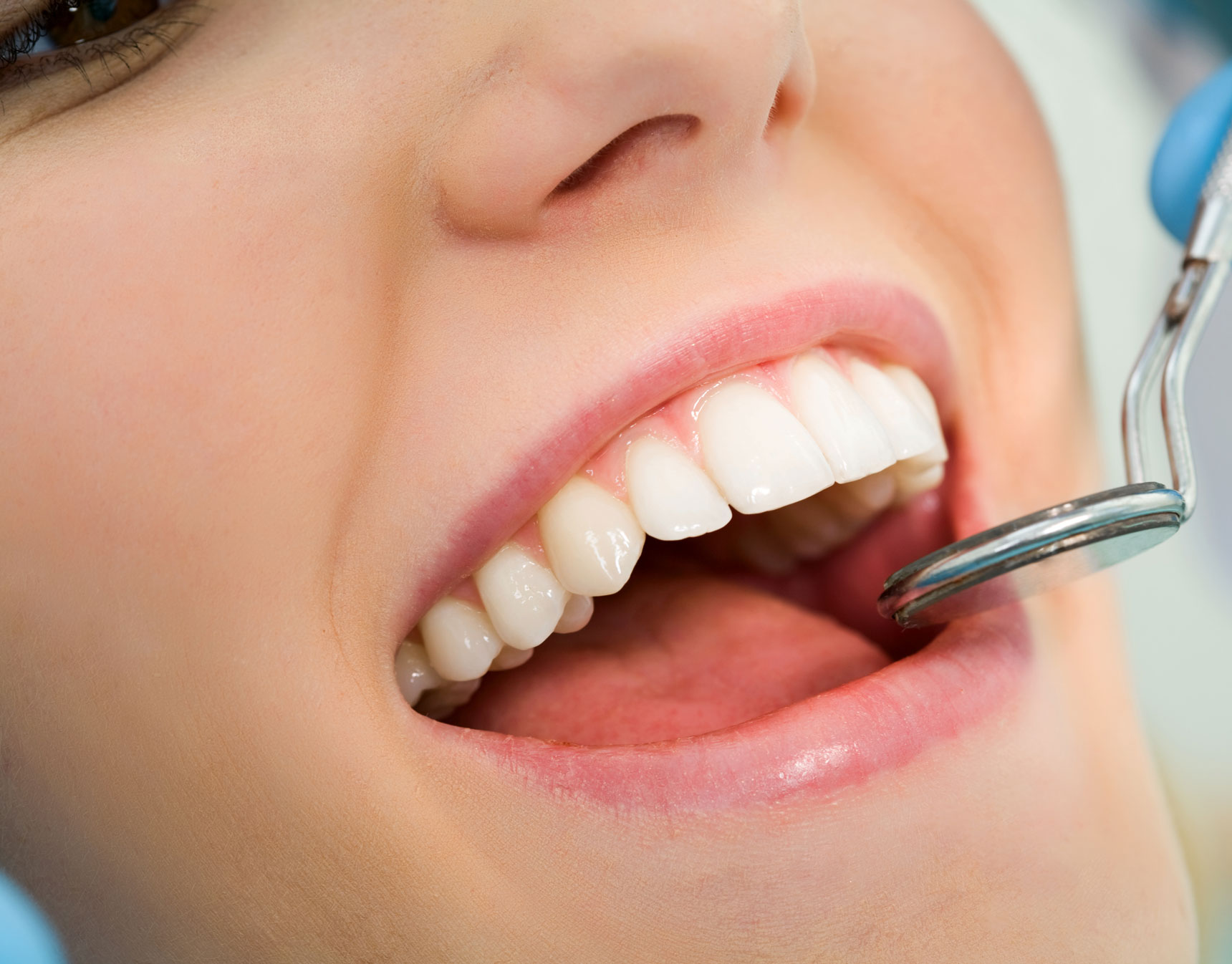 Gum Lifts Houston Tx | Gum Contouring & Gingivectomy by Dr. Moe