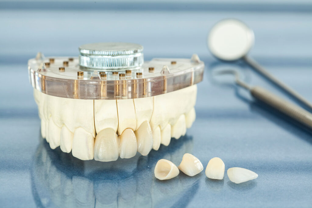 teeth veneers houston